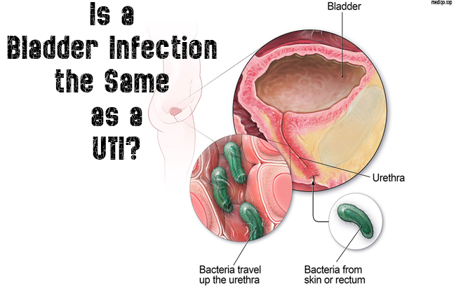Is a Bladder Infection the Same as a UTI?