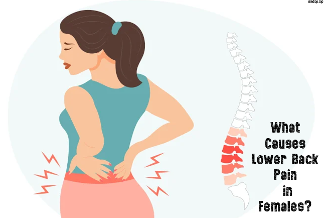 What Causes Lower Back Pain in Females?