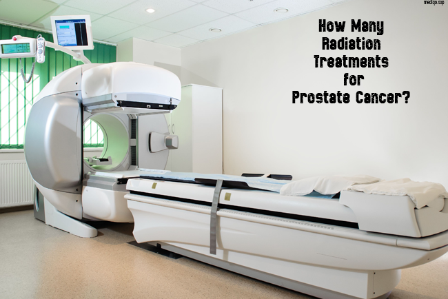 how many radiation treatments for prostate cancer