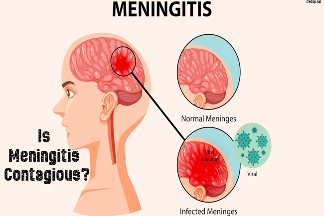 is meningitis contagious