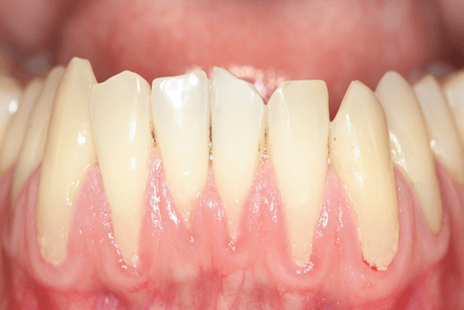 gum disease treatment near me