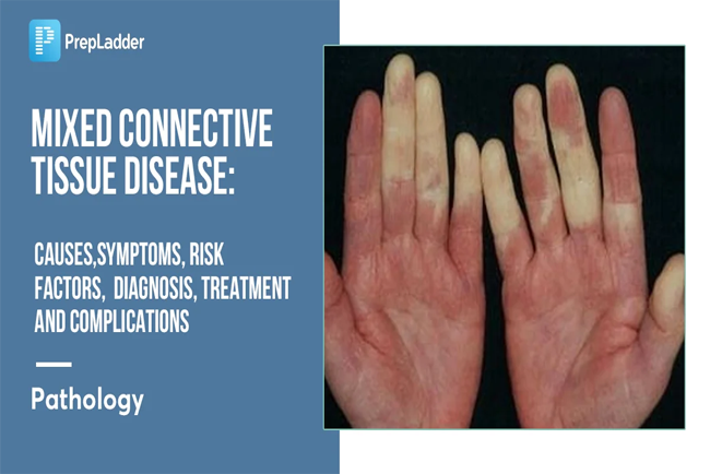 how rare is mixed connective tissue disease