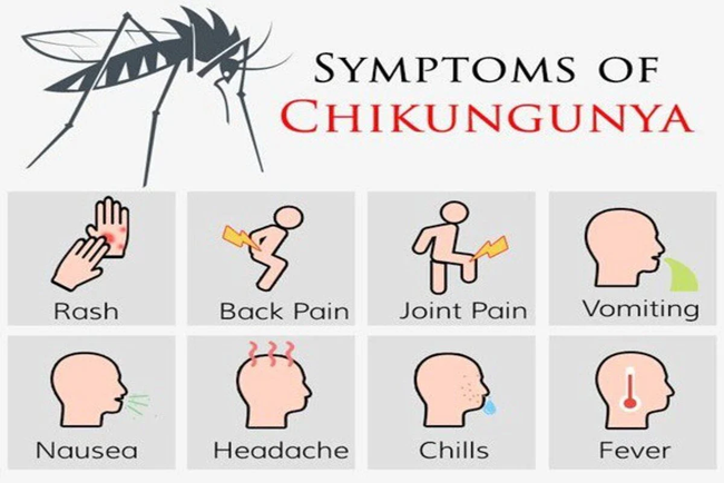 Chikungunya