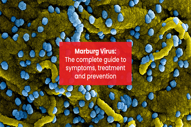 Marburg Virus
