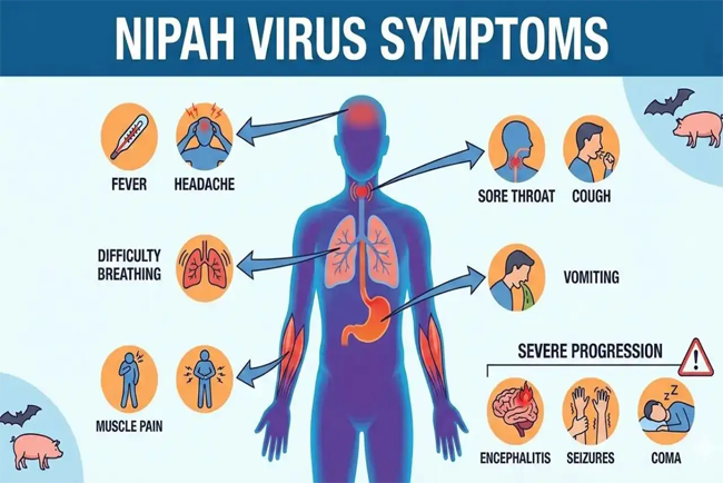 Nipah Virus