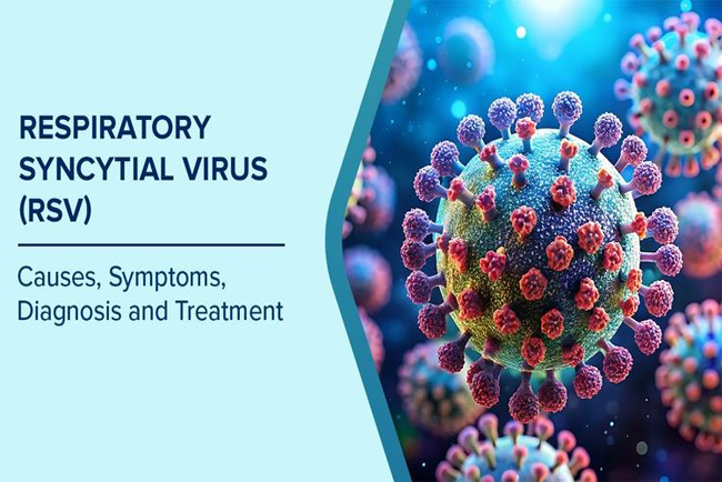 RSV (Respiratory Syncytial Virus)