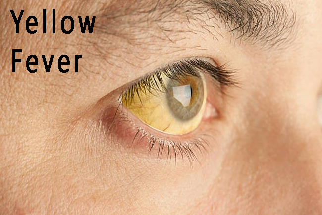 Yellow Fever