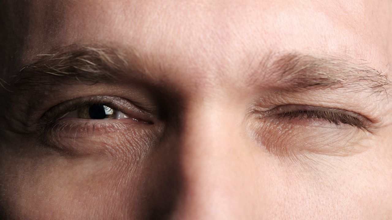 Blepharospasm
